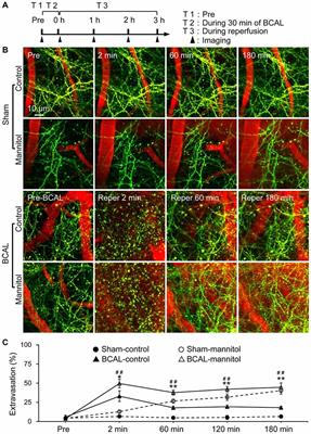 Increased BBB Permeability Enhances Activation of Microglia and Exacerbates Loss of Dendritic Spines After Transient Global Cerebral Ischemia